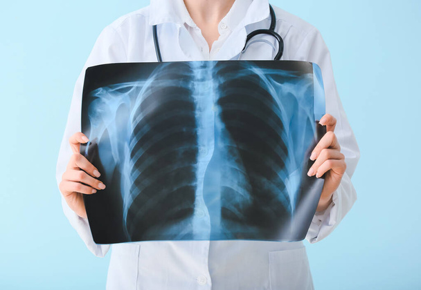 Female doctor holding x-ray scan of lungs on color background - Photo, image