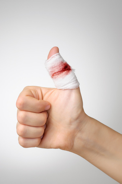 Dedo lesionado con vendaje sangriento
 - Foto, Imagen