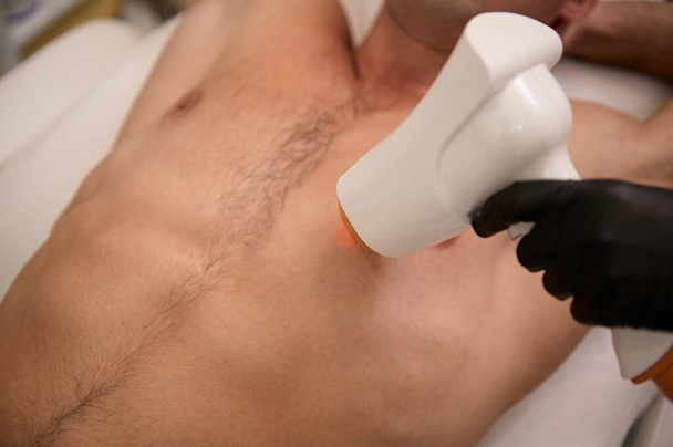Egy férfi törzsének felső nézete egy szőrtelenítő eljárás során egy lézeres epilációs stúdióban. Lézeres szőrtelenítés férfiaknak modern ultrahangos szőrtelenítő géppel. Férfi gyantázás. Közelkép. - Fotó, kép