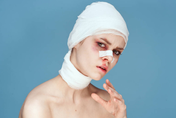 woman bruised face medicine treatment injury isolated background - Фото, изображение