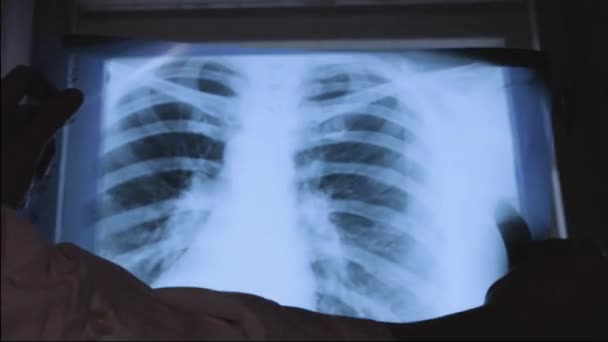De dokter houdt een röntgenfoto van de longen in zijn handen, onderzoekt het tegen de achtergrond van het raam. Longletsels. - Video
