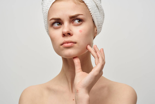 bella donna con un asciugamano sulla mia testa dermatologia sfondo isolato - Foto, immagini