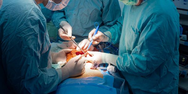 Doctors cut out the malignant tumor - Fotó, kép
