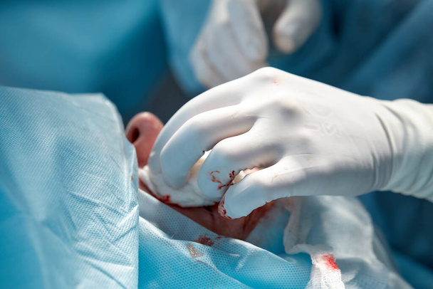 Закрыть лицо пациента, который проходит блефаропластику. Хирург режет веко и выполняет манипуляции с помощью медицинских инструментов - Фото, изображение
