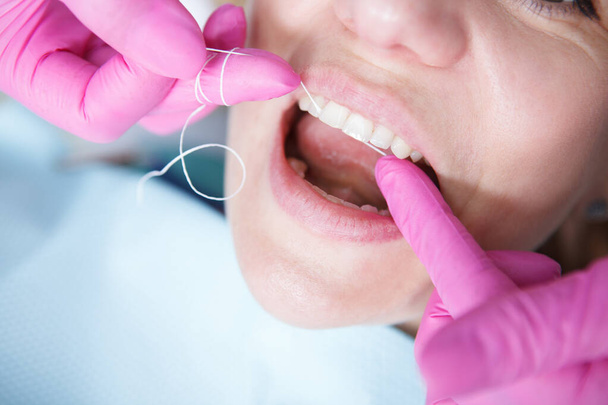 rajattu lähikuva hammaslääkäri käyttäen hammaslankaa, puhdistus hampaat potilaan - Valokuva, kuva