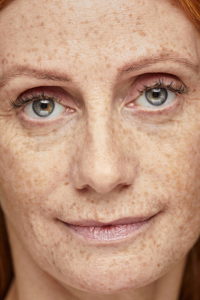 Freckled Woman No Makeup - Photo, Image