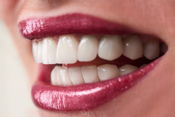 Женский рот с белыми зубами
 - Фото, изображение