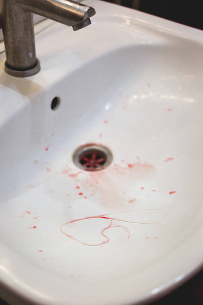 Biała umywalka, pozostałości nici dentystycznej, plamy krwi od uszkodzenia dziąseł nicią dentystyczną. - Zdjęcie, obraz