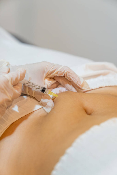 Mesotherapy treatment. Beautician applying an injection in the belly of a woman for fat reduction and body contouring. Close up. - Valokuva, kuva