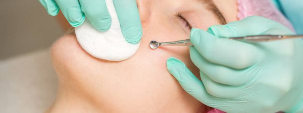 Die Kosmetikerin entfernt Mitesser und Akne auf dem weiblichen Gesicht in einem Schönheitssalon, Mitesser Entfernungswerkzeug - Foto, Bild