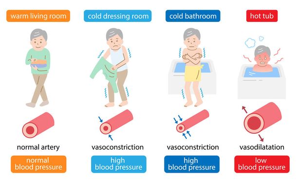 風呂の突然の極端な変化は老人の体の血圧に有害である可能性があります。血管収縮と血管拡張図.ヘルスケアの概念 - ベクター画像