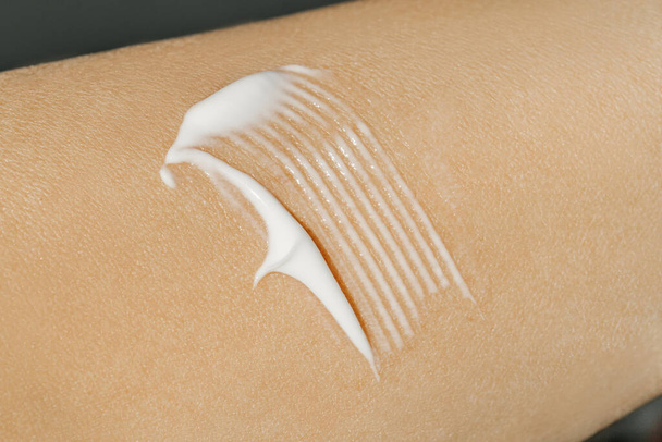The texture of the white cream on the skin. - Valokuva, kuva
