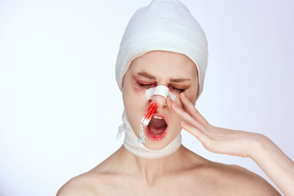 emotional woman tampon in the nose with blood injured face isolated background - Zdjęcie, obraz
