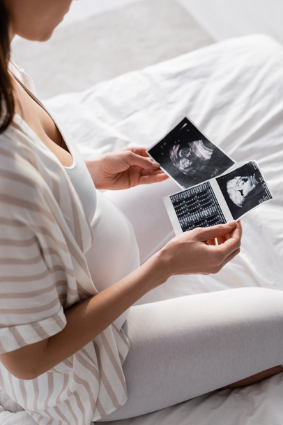 Vista parcial da mulher grávida que realiza exames de ultra-som
  - Foto, Imagem