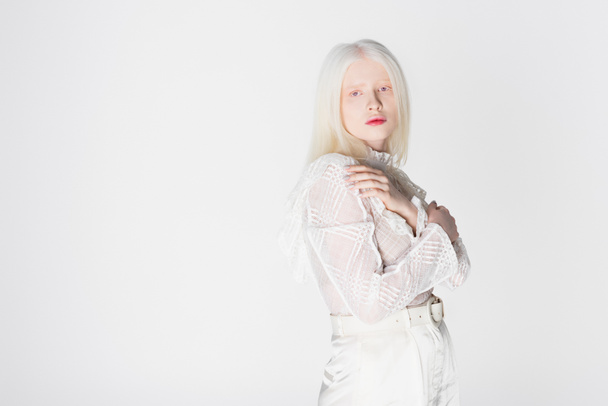 Hezký albín žena dívá na kameru při pózování izolované na bílém  - Fotografie, Obrázek