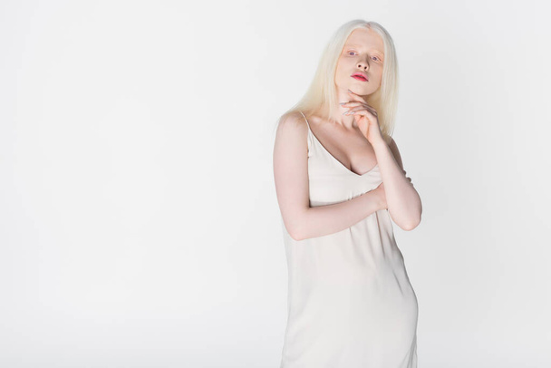 Joven rubia y albina posando aislada sobre blanco  - Foto, imagen