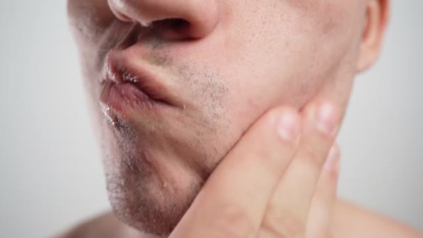 Yakın plan, sakallı erkek yüzü. Tıraş olduktan sonra yüz tahrişi - Video, Çekim