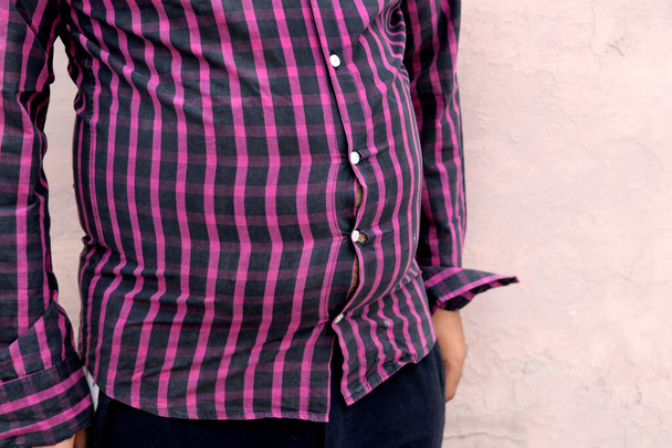 Un hombre gordo con camisa ajustada, inseguridades de apariencia, desequilibrio hormonal - Foto, imagen