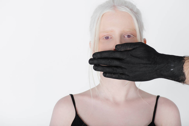Männliche Hand in schwarzer Farbe bedeckt Mund von Albino-Modell isoliert auf weiß - Foto, Bild