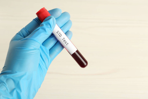 Scientist holding tube with blood sample and label STD Test on white background, closeup. Space for text - Fotó, kép