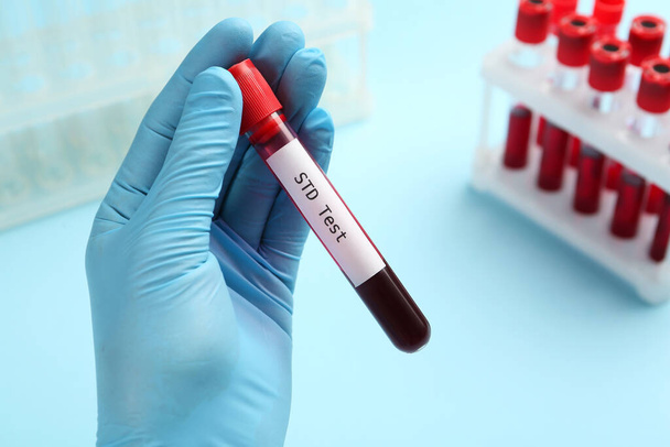 Scientist holding tube with blood sample and label STD Test on light blue background, closeup - Fotoğraf, Görsel