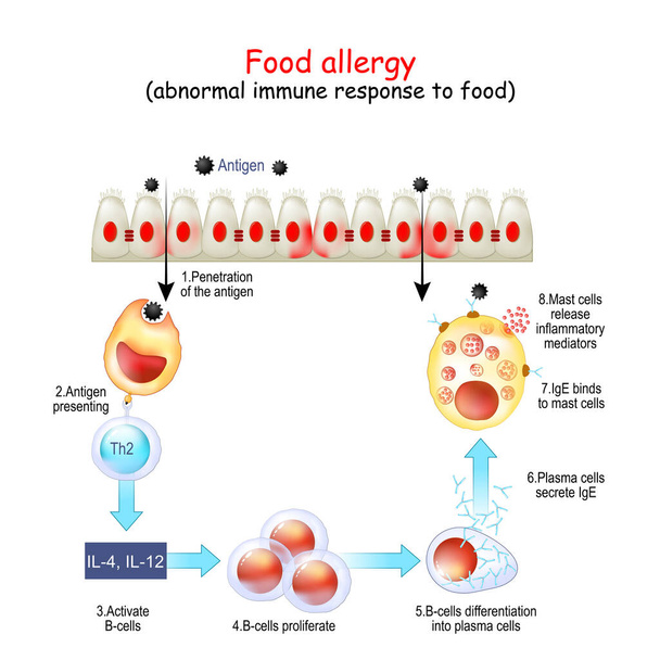 Food allergy. abnormal immune response to food. Reaction of immune system from Penetration of the antigen and B-cells Activation to IgE secretion and release inflammatory mediators of Mast cells. Vector poster for education - Vector, Image