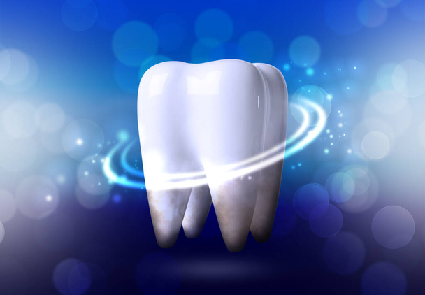Tooth model with glowing on blue background, bokeh effect. Dental care - Foto, Bild