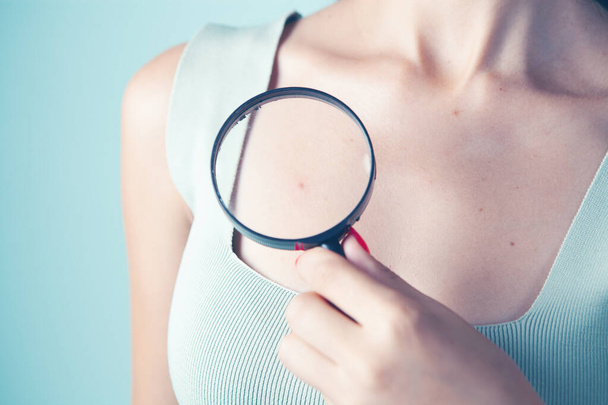 woman holding a magnifying glass. pimple on the body - Фото, изображение