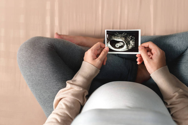 Asian pregnant woman holding ultrasound scan image, Expectation of a child and Maternity prenatal care and woman pregnancy concept. - Fotoğraf, Görsel