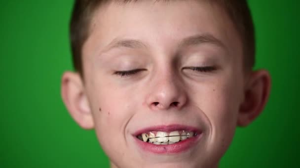 Úsměv dítě, chlapec nosí talíř pro vyrovnání zubů, zubní péče. - Záběry, video