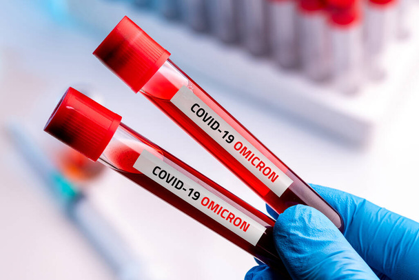 Lekarz z próbką krwi Covid-19 Omicron B.1.1.529 Wariant i ogólne dane dotyczące mutacji Covid-19 Coronavirus. - Zdjęcie, obraz