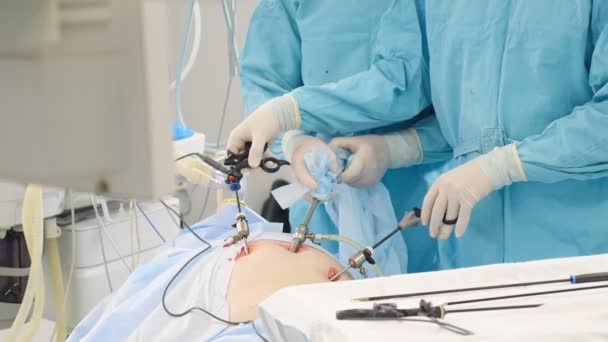Sala operacyjna, zespół chirurgów wykonujący laparoskopową interwencję. Nowoczesna medycyna, sprzęt medyczny w szpitalu. Narzędzia i ręce do laparoskopu. Lekarze używają endo-instrumentów i kamer wideo. 4 k - Materiał filmowy, wideo