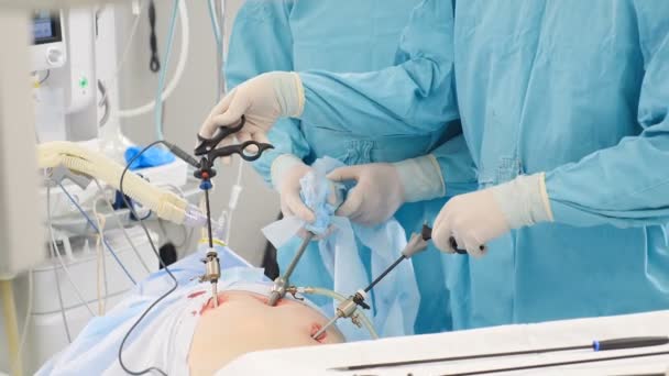 Egészségügyi koncepció. A sebész asszisztensekkel laparoszkópos műtétet végez. Függőleges felvétel. Az orvosok endo-eszközöket és videokamerákat használnak a hasüregben. Modern fejlett berendezések - Felvétel, videó
