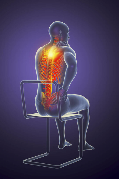 Боль в позвоночнике, боли в спине, концептуальная 3D иллюстрация, показывающая мужское тело с выделенным скелетом, имеющим болевую спину. Спинной вид - Фото, изображение