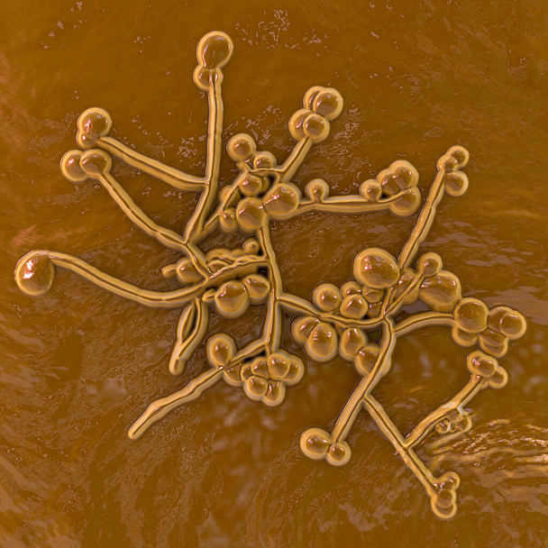 Candida-sienet, Candida albicans, C. auris ja muut ihmisen patogeeniset hiivat, 3D-kuva. Viileä-19 komplikaatio. Valkoinen sieni - Valokuva, kuva