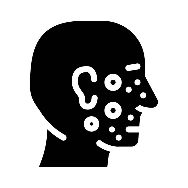 acné visage maladie de peau glyphe icône vectoriel illustration - Vecteur, image