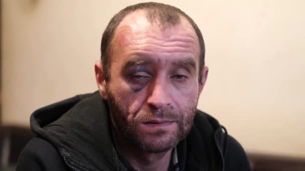Drunk pensive man with a hematoma under the eye.  - Footage, Video