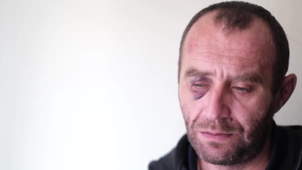 Sad man with a bruise under his eye. - Footage, Video