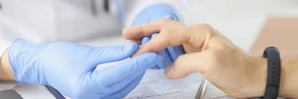 Mężczyzna z problemem złuszczania skóry na rękach podczas wizyty u lekarza - Zdjęcie, obraz
