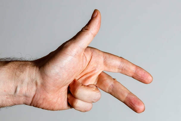 Eine Hand mit 3 Fingern - Foto, Bild