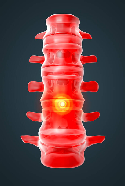 3d rendered illustration-lumbar side view - Photo, image