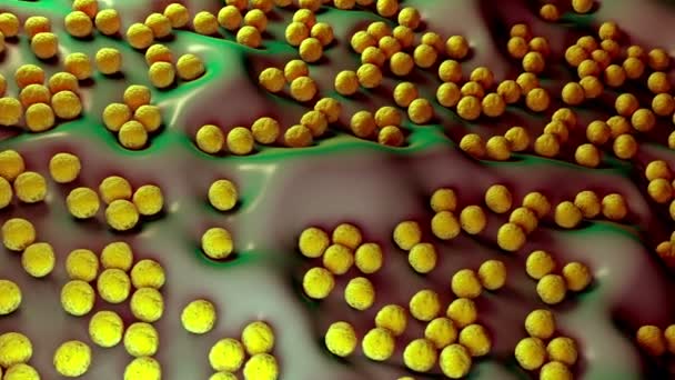 superbug of Staphylococcus aureus (MRSA) bacterie - Video