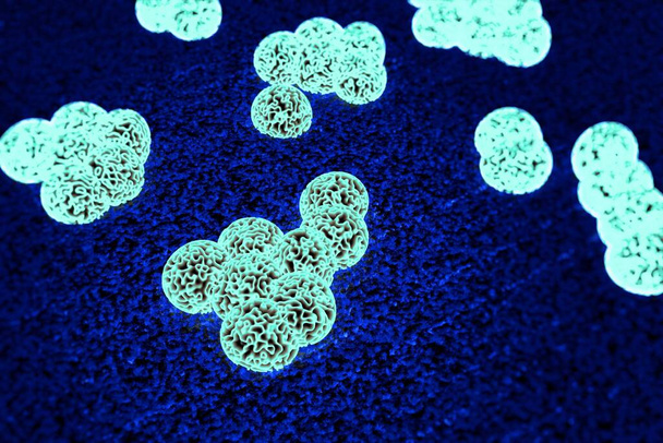 Staphylococcus aureus résistant à la méthicilline (SARM ou Superbug) est une bactérie responsable de plusieurs infections difficiles à traiter chez l'humain. - Photo, image