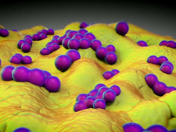 szuperbogár vagy Staphylococcus aureus (MRSA) baktériumok - Fotó, kép
