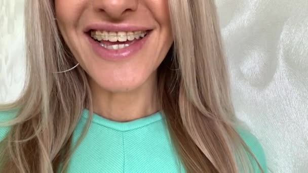 Gyönyörű nő zafír fogszabályzóval mosolygós - Felvétel, videó