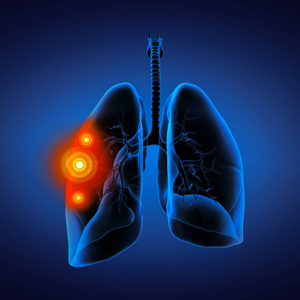 Illustrazione medica 3D - polmoni vista posteriore - Foto, immagini
