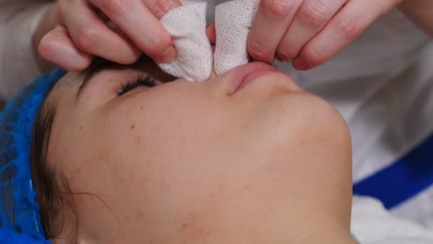 A kozmetikus arcmechanikai tisztítást végez. Kozmetológus szorítsa pattanások arcbőr orr ujjaival. Bőrápolási eljárás. Pattanások és pattanások kezelése a klinikán. problémás bőr. 4 k videó - Felvétel, videó