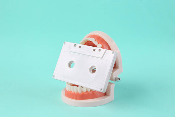 Concepto de música mínima. Modelo de mandíbula humana con casete de audio en dientes sobre fondo azul - Foto, imagen