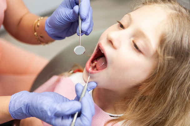 Sweet little girl in the dental chair. The dentist examines the teeth of the child's patient. Pediatric dentistry - Φωτογραφία, εικόνα