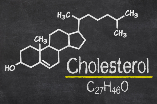 Blackboard with the chemical formula of cholesterol - Photo, Image